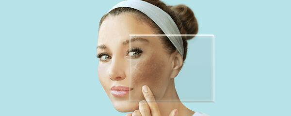 How to recognize if you have dry, oily or sensitive skin - and why it matters.