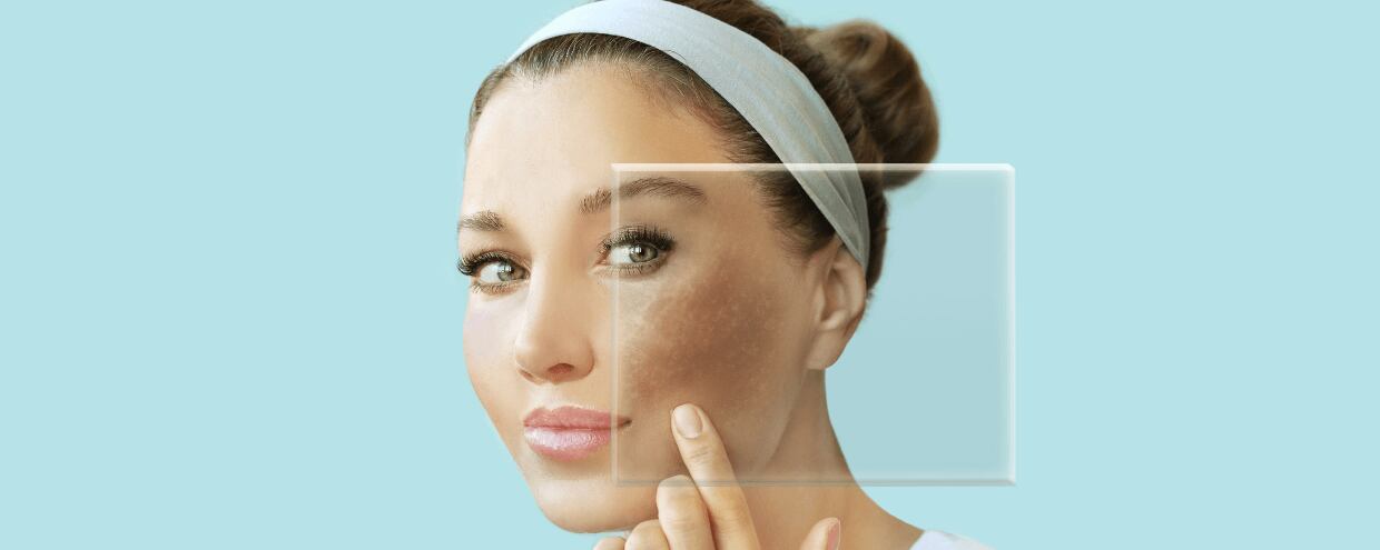 How to recognize if you have dry, oily or sensitive skin - and why it matters.